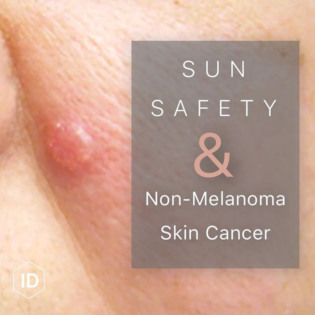 skin cancer from the sun