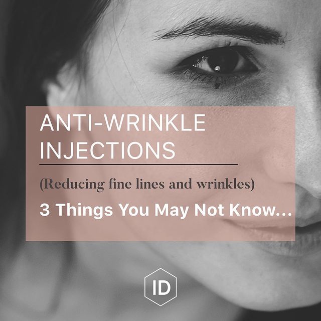 3 things you may not know about anti-wrinkle injections