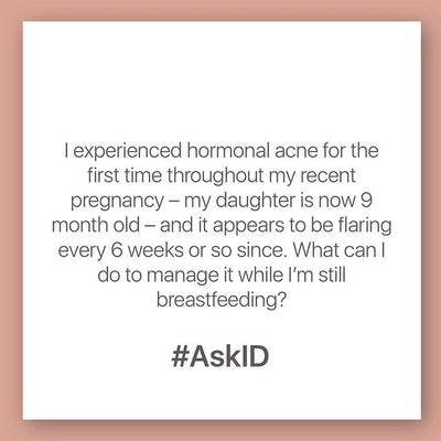 #AskID: Hormonal Acne