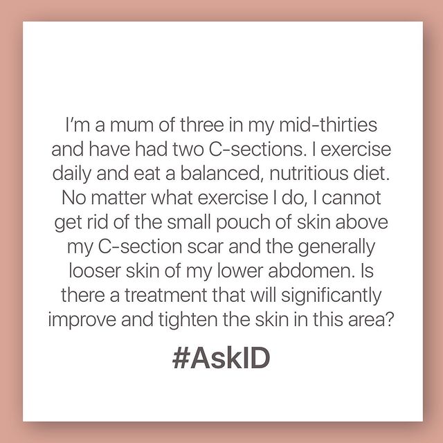 AskID: Looser skin on lower abdomen
