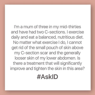 AskID: Looser skin on lower abdomen