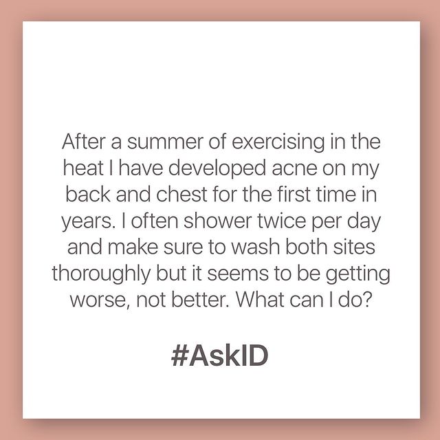 AskID: Back & chest acne