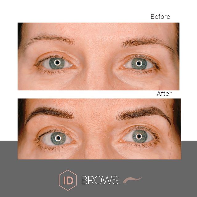 ID Brows: before & after