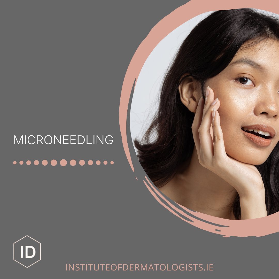 What is Microneedling?