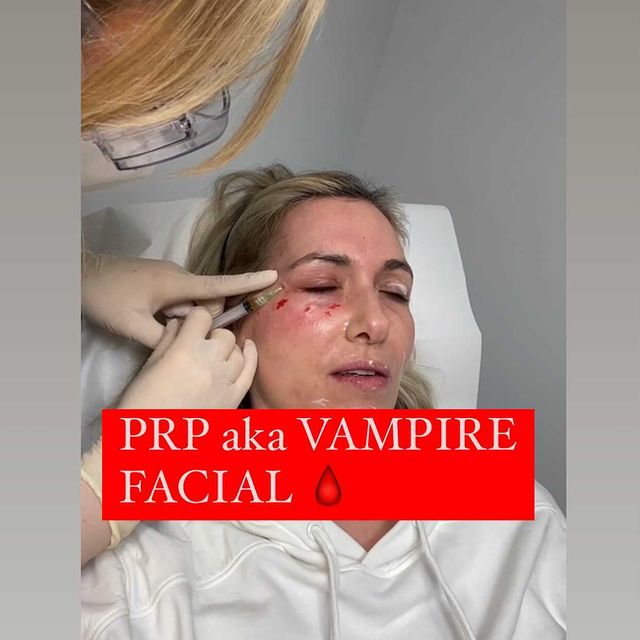 PRP