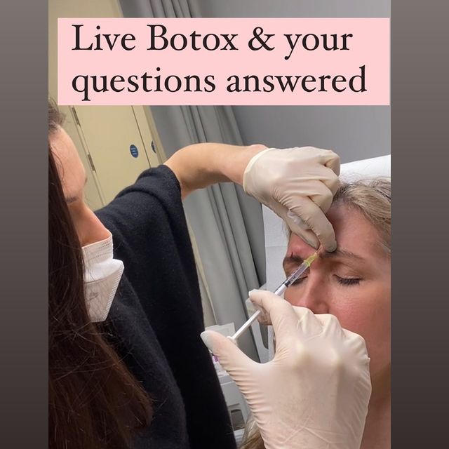 Botox with Prof. Ryan