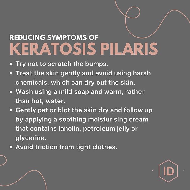 Keratosis Pilaris