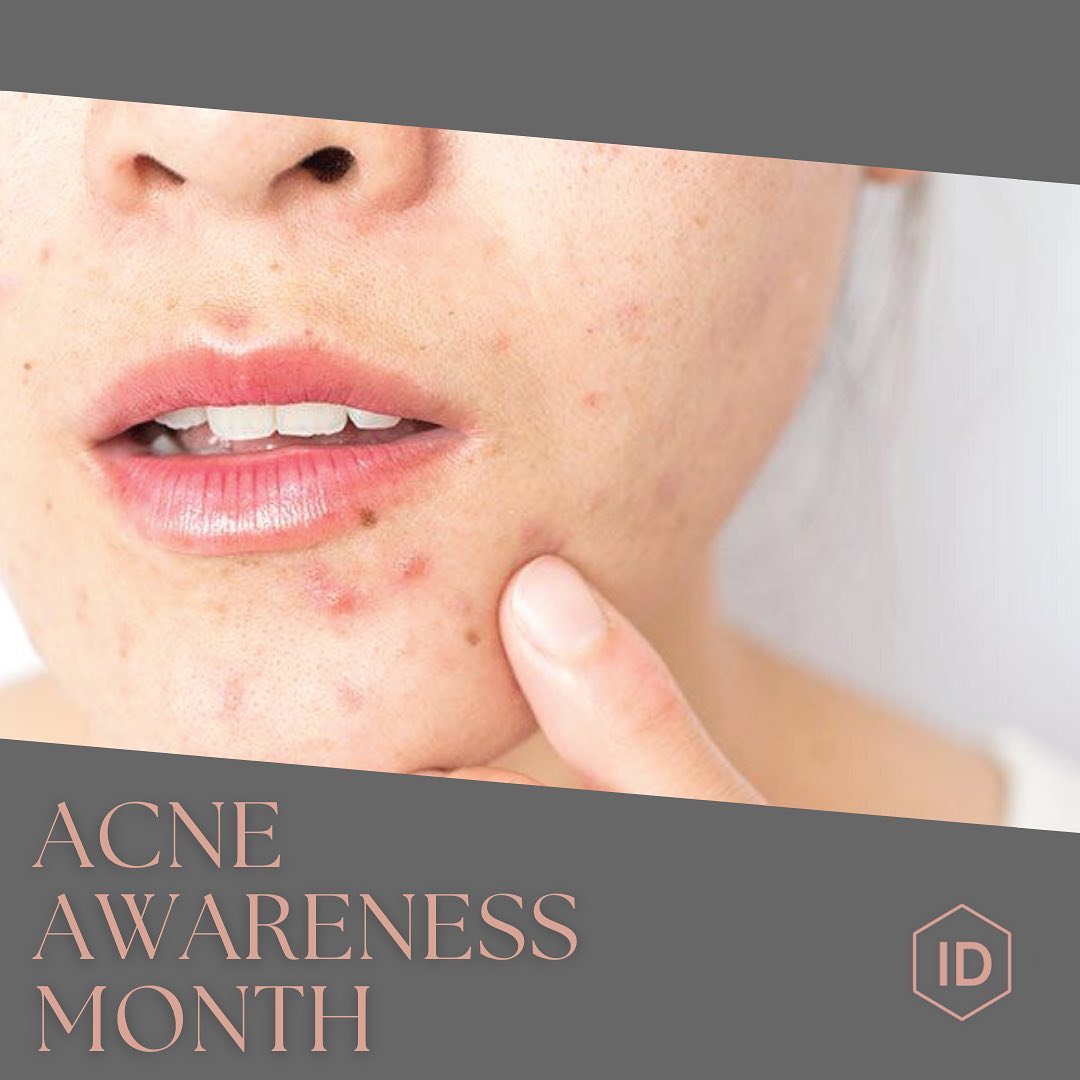 Acne Awareness Month