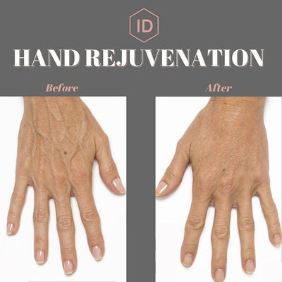 Are your hands your biggest skin concern?
