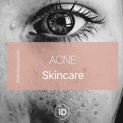 #idknowsyourskin: Acne Skincare