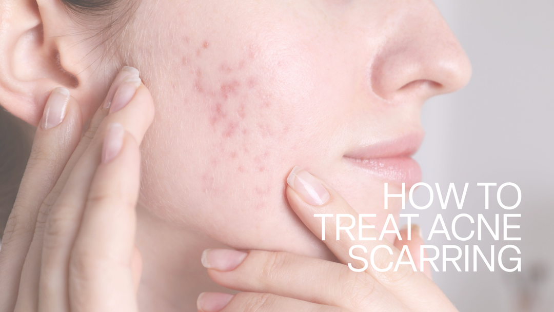 acne awareness - institute of dermatologists