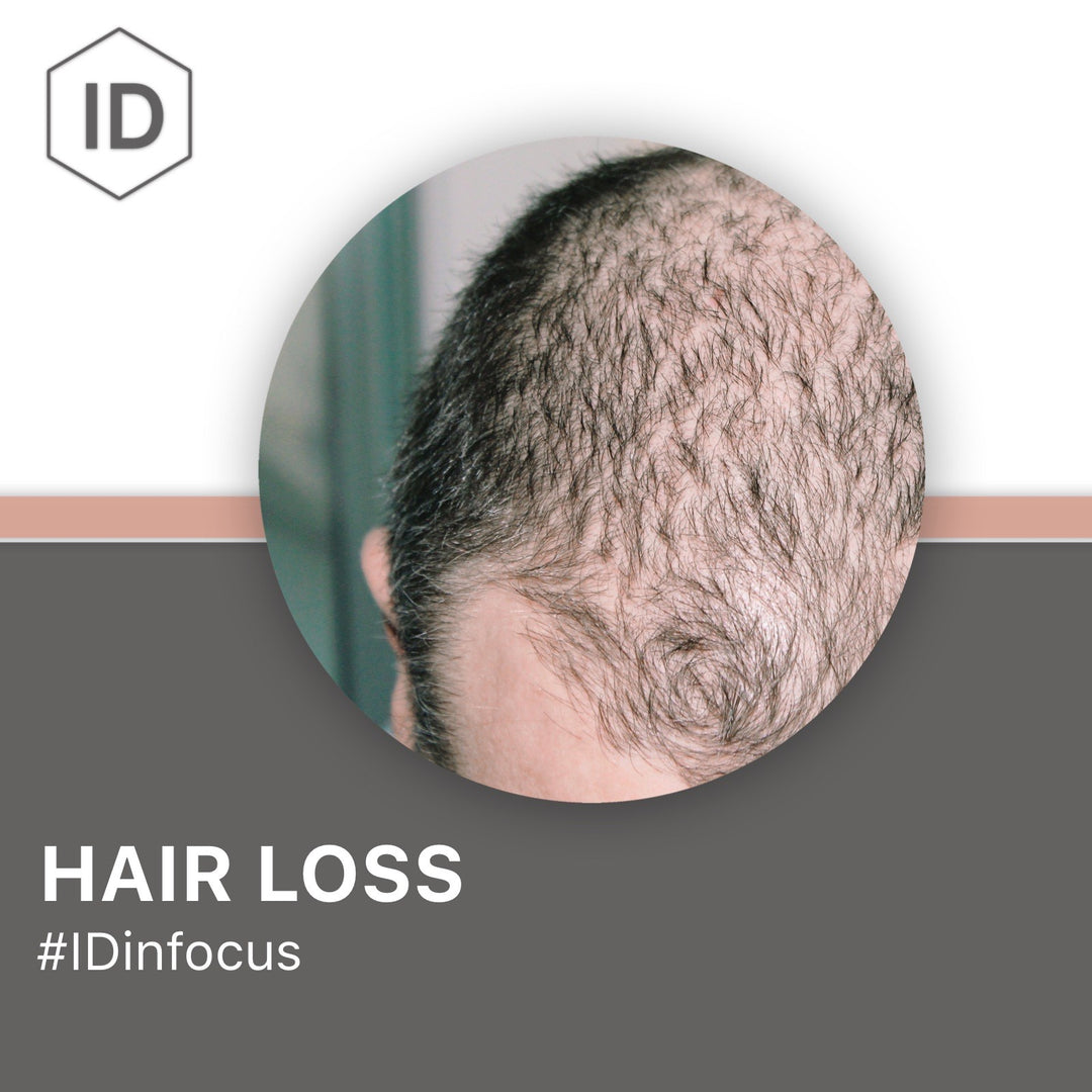 Hair Loss