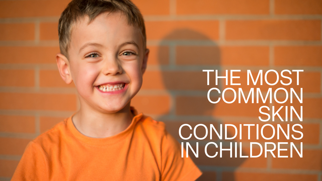 Smiling child in an orange T-shirt beside the words The Most Common Skin Conditions in Children