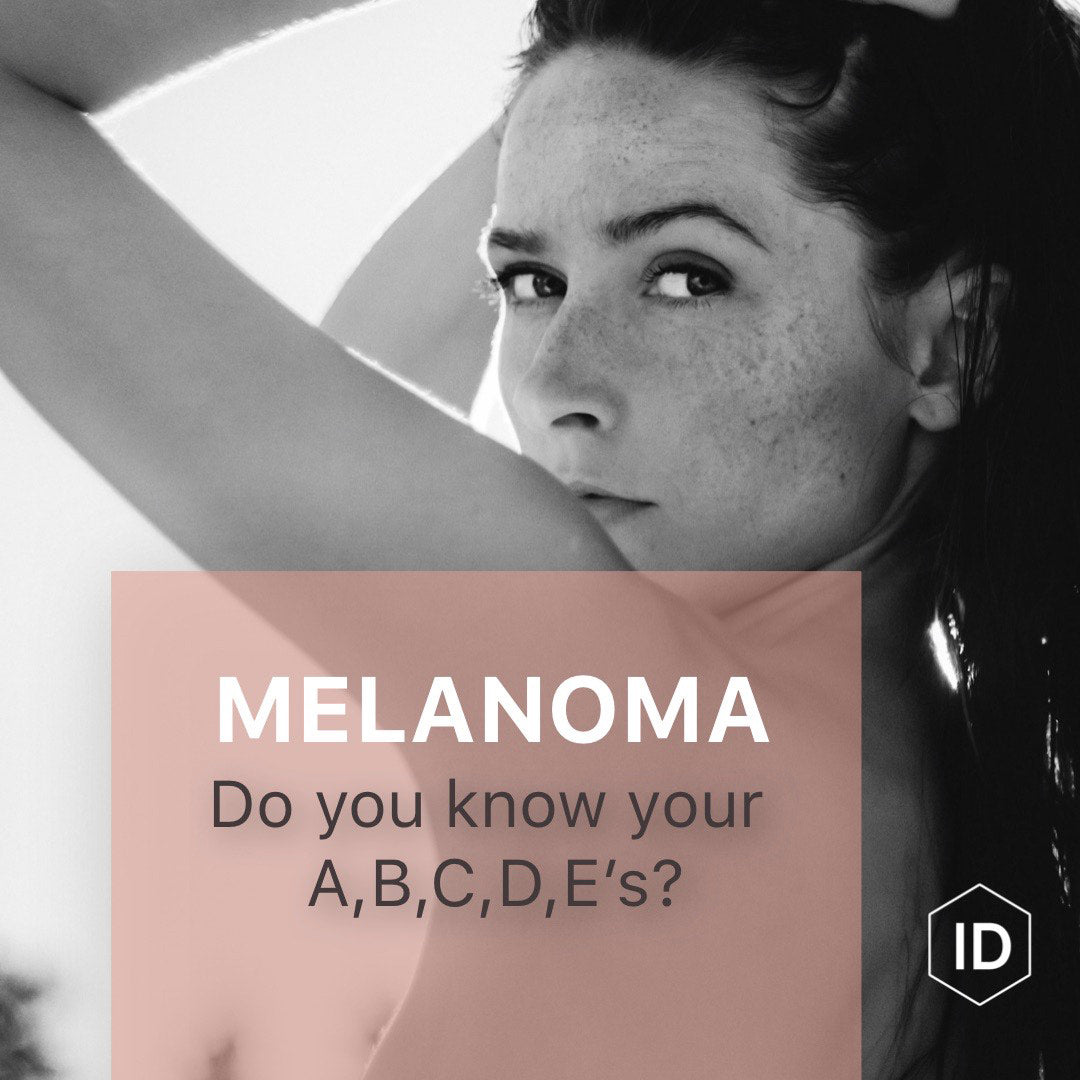 Melanoma