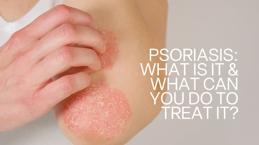 Psoriasis: What It Is, What Triggers It, and How Skincare Fits In