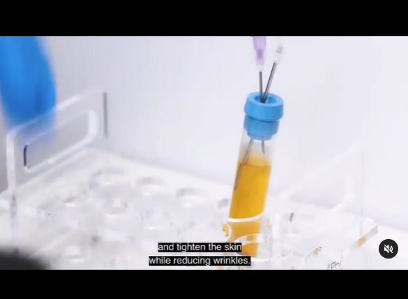 PRP (platelet-rich plasma) treatment