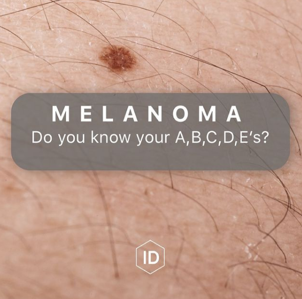 MELANOMA AWARENESS