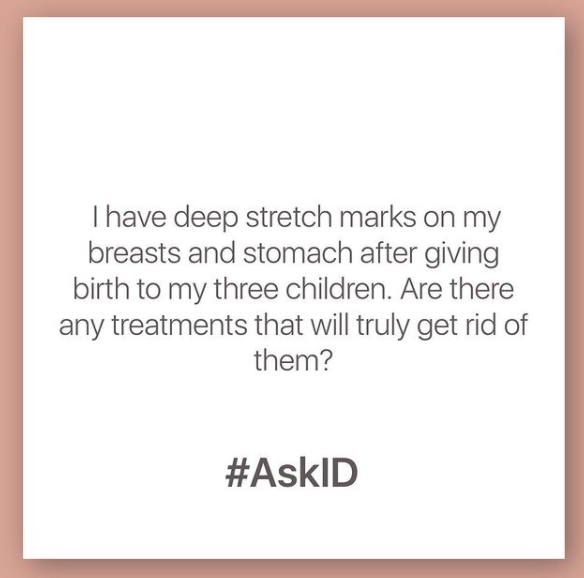 #AskID : Prof Niki Ralph about Stretch marks or Striae