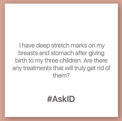 #AskID : Prof Niki Ralph about Stretch marks or Striae