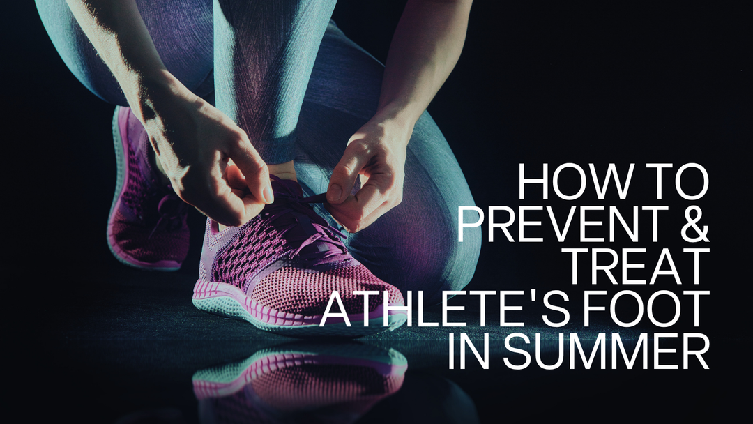 How Do You Prevent and Treat Athlete's Foot in Summer