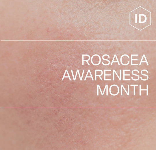 Building a Rosacea-Safe Skincare Routine