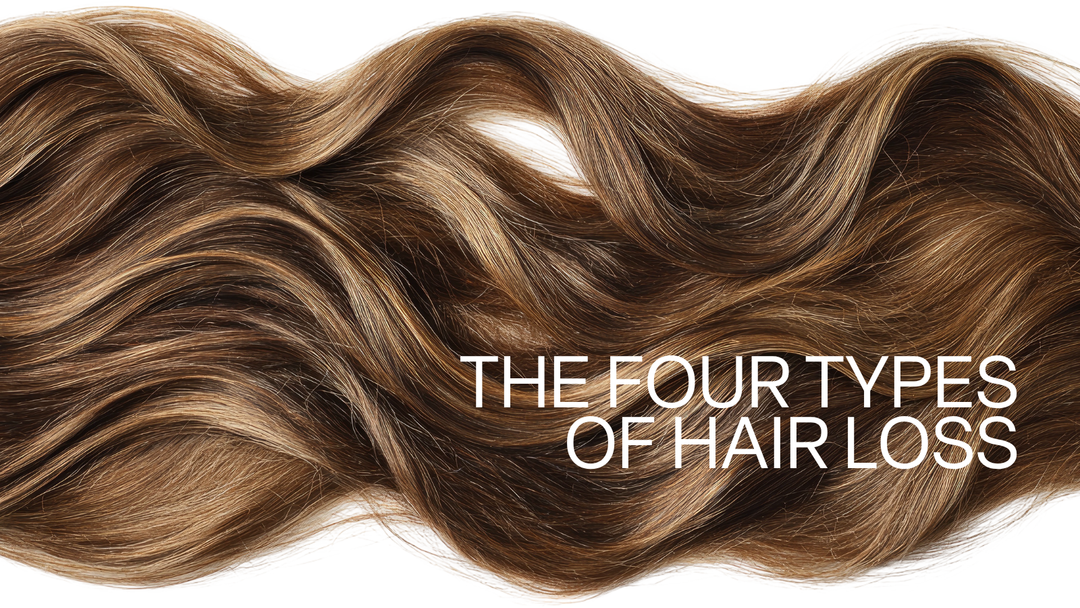 Illustration showing the four main types of hair loss