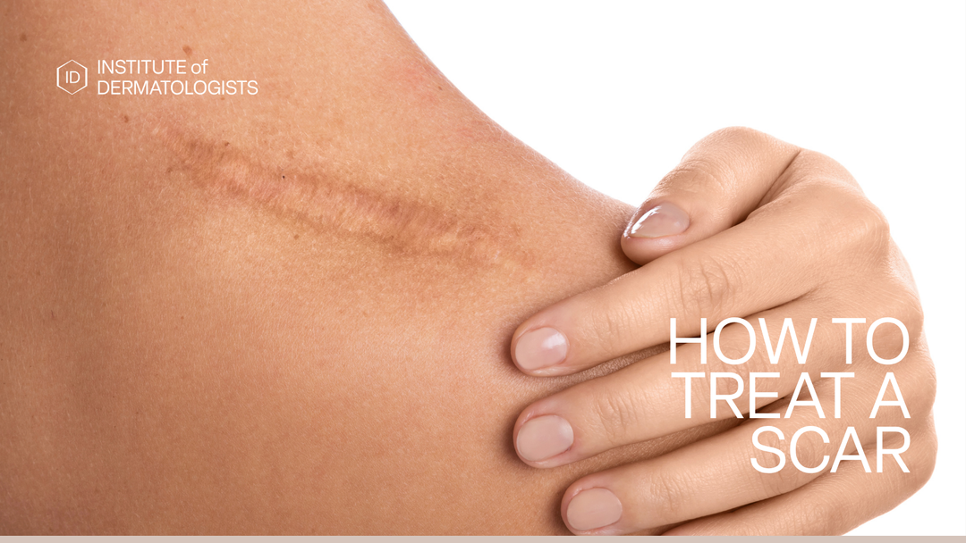 Medical-grade silicone sheet applied to a raised scar as part of silicone scar therapy