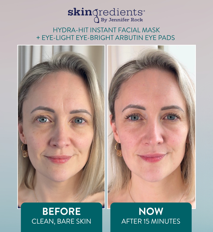Skingredients Eye-Light Eye-Bright Arbutin Under Eye Pads