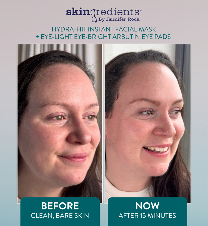 Before and after comparison of facial skin treatment with 'skin ingredients' products.