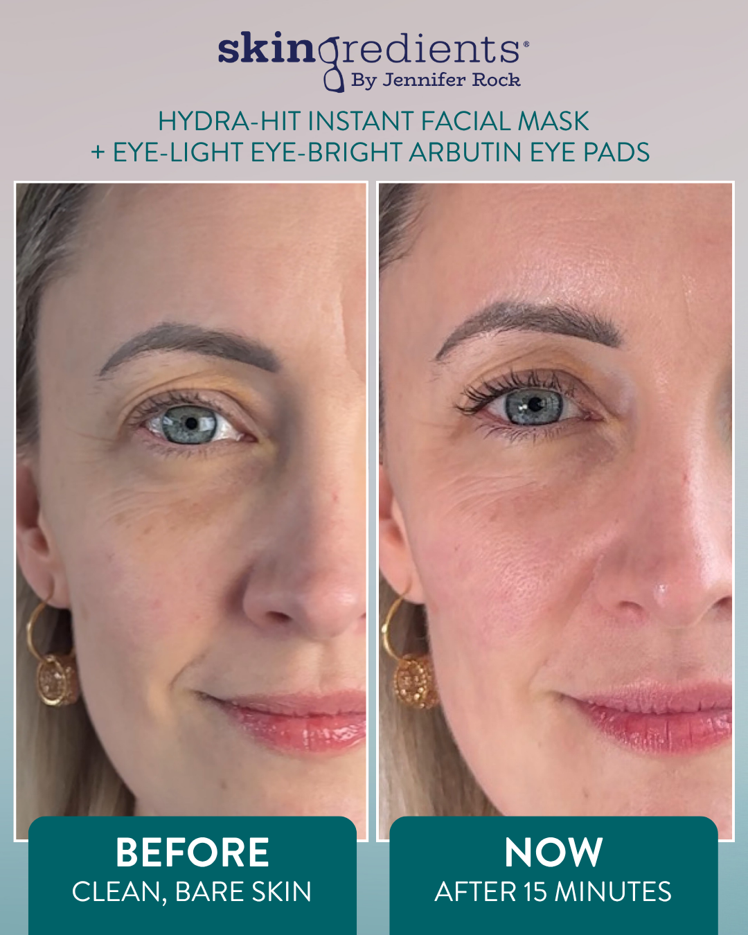 Skingredients Hydra-Hit Instant Facial Mask