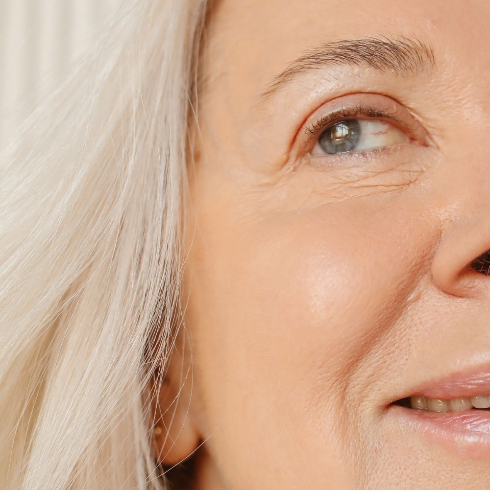 Dehydrated Skin: Ultimate Tips to Restore Hydration Fast