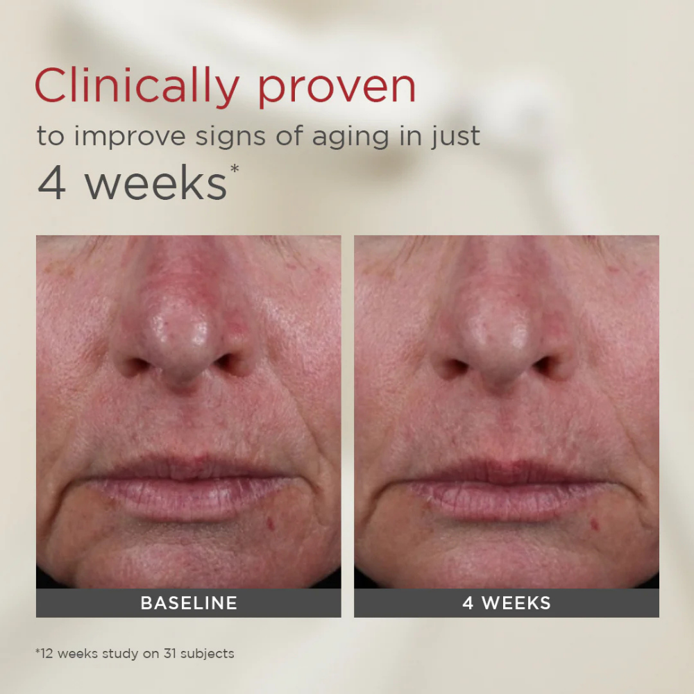 Before and after comparison of skin texture with text claiming improvement in signs of aging.