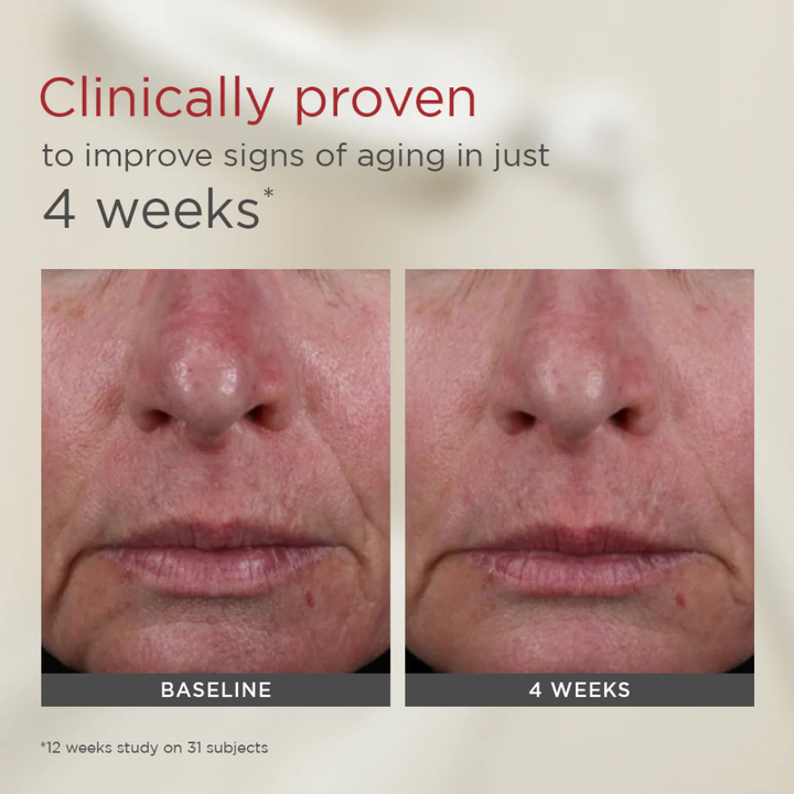 Before and after comparison of skin texture with text claiming improvement in signs of aging.