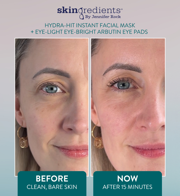 Before and after comparison of facial skin with 'skinGREDIENTS' product application.
