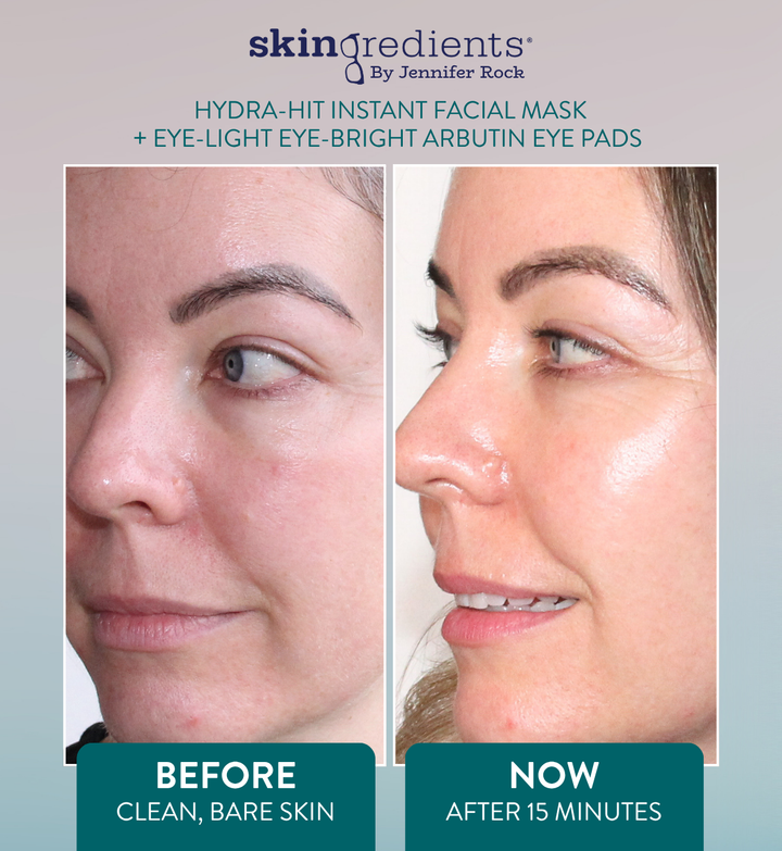Before and after comparison of facial skin treatment with 'skin ingredients' branding.