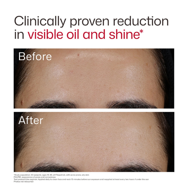 EltaMD UV Clear Blemish-Prone & Oil Balancing SPF 50