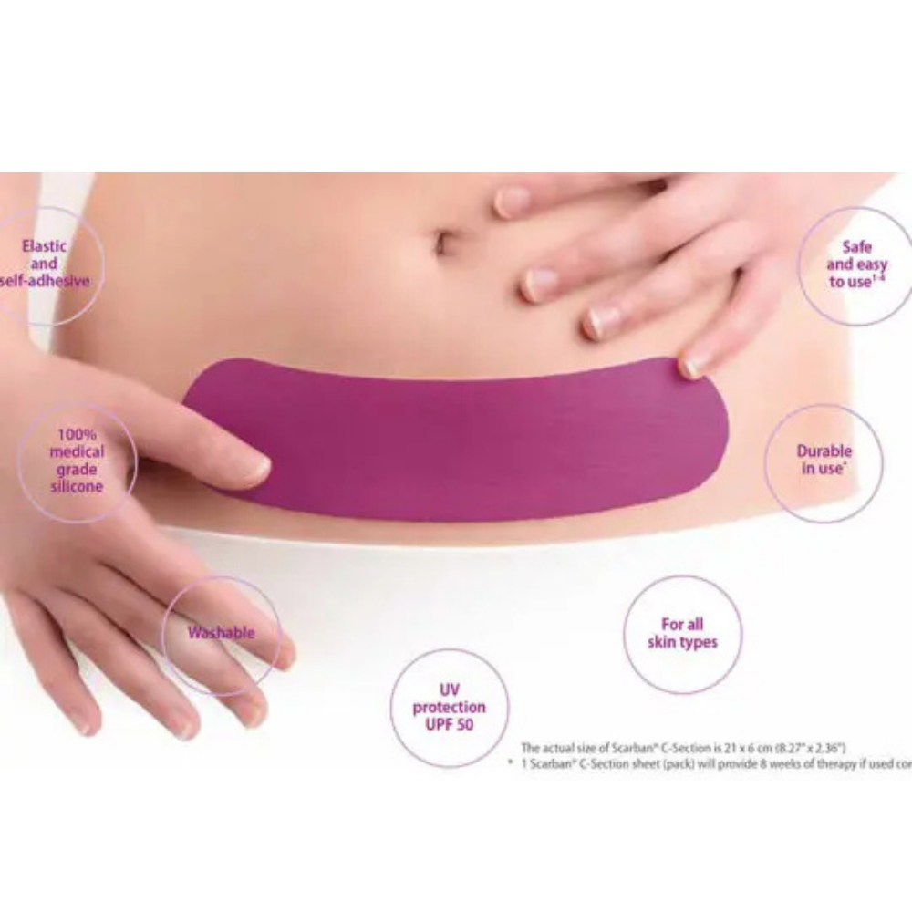 C-Section scar sheet, purple medical-grade silicone, pre-shaped with rounded edges for lower-abdomen scar care