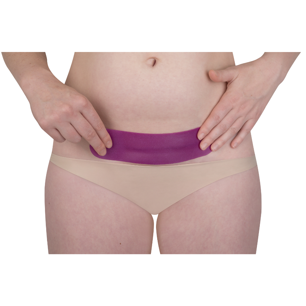 C-Section scar silicone sheet in purple, pre-shaped and self-adhesive across the lower abdomen