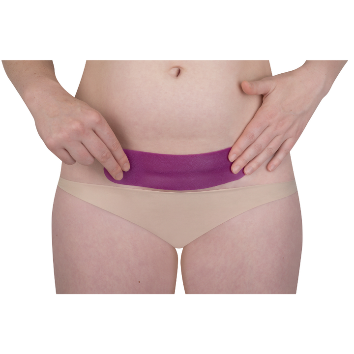 C-Section scar silicone sheet in purple, pre-shaped and self-adhesive across the lower abdomen