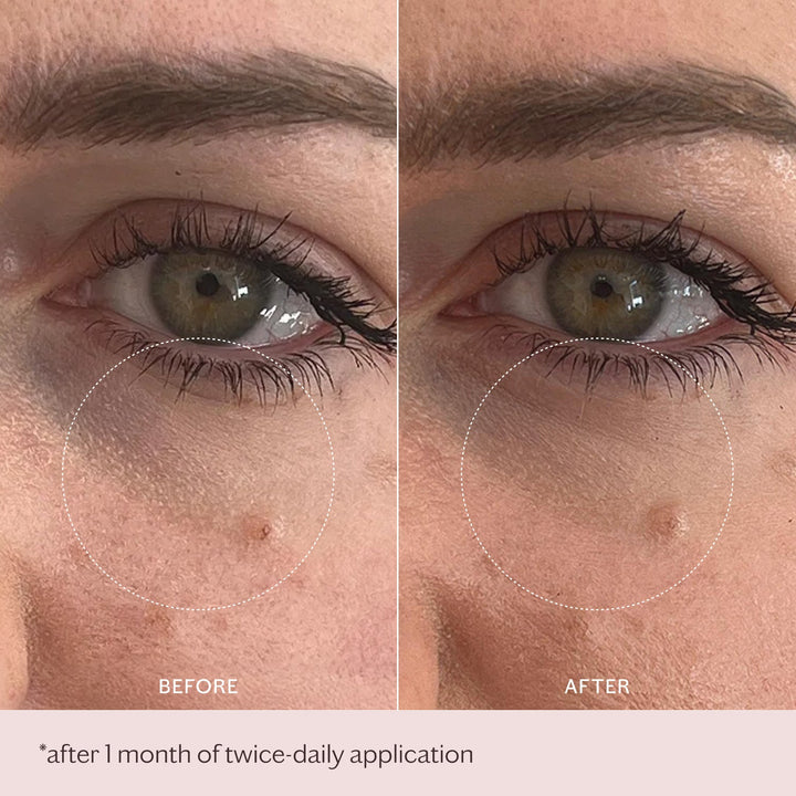 MZ Skin Intensive Bio-Placenta Eye Cream before-and-after under-eye treatment comparison showing smoother, brighter skin