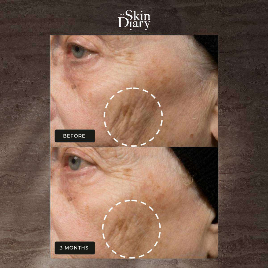 Night Repair Therapy anti-ageing skincare before and after image showing reduced wrinkles around the eye after three months