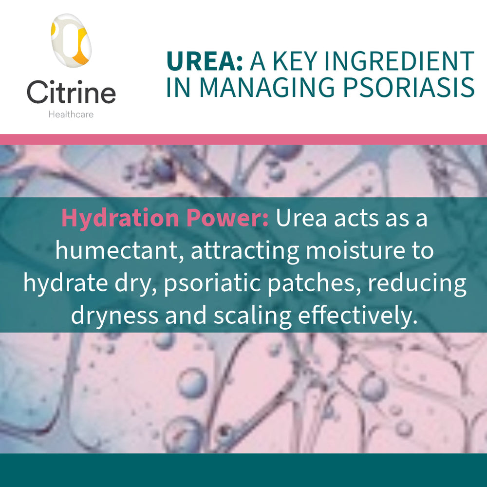 Sorato EU10 Intensive Moisturising Cream graphic highlighting urea hydration for dry, scaly and psoriatic skin
