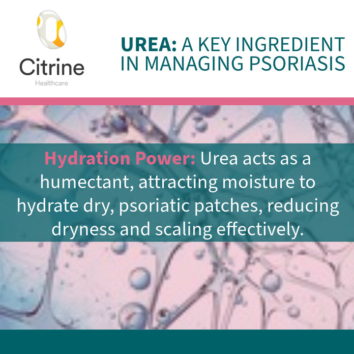 Sorato EU10 Intensive Moisturising Cream graphic highlighting urea hydration for dry, scaly and psoriatic skin
